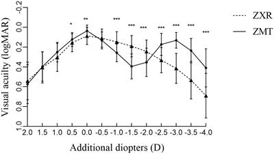 Comparison of cataract patients with regular corneal astigmatism after implantation of extended range-of-vision and bifocal toric intraocular lenses